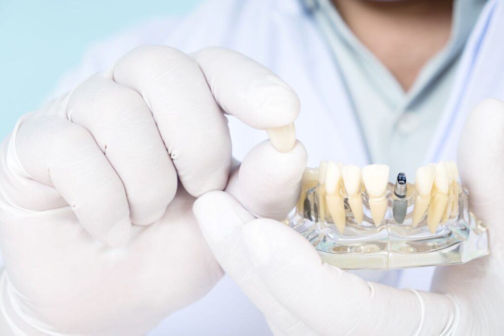 Dentist in white gloves holding dental crown of sample implant in clear base