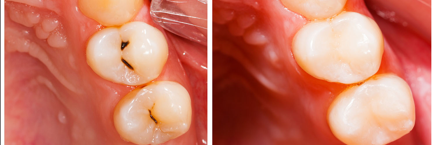 DentaCrafters PLLC