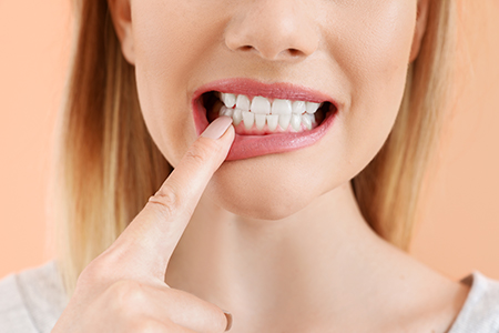 DentaCrafters PLLC